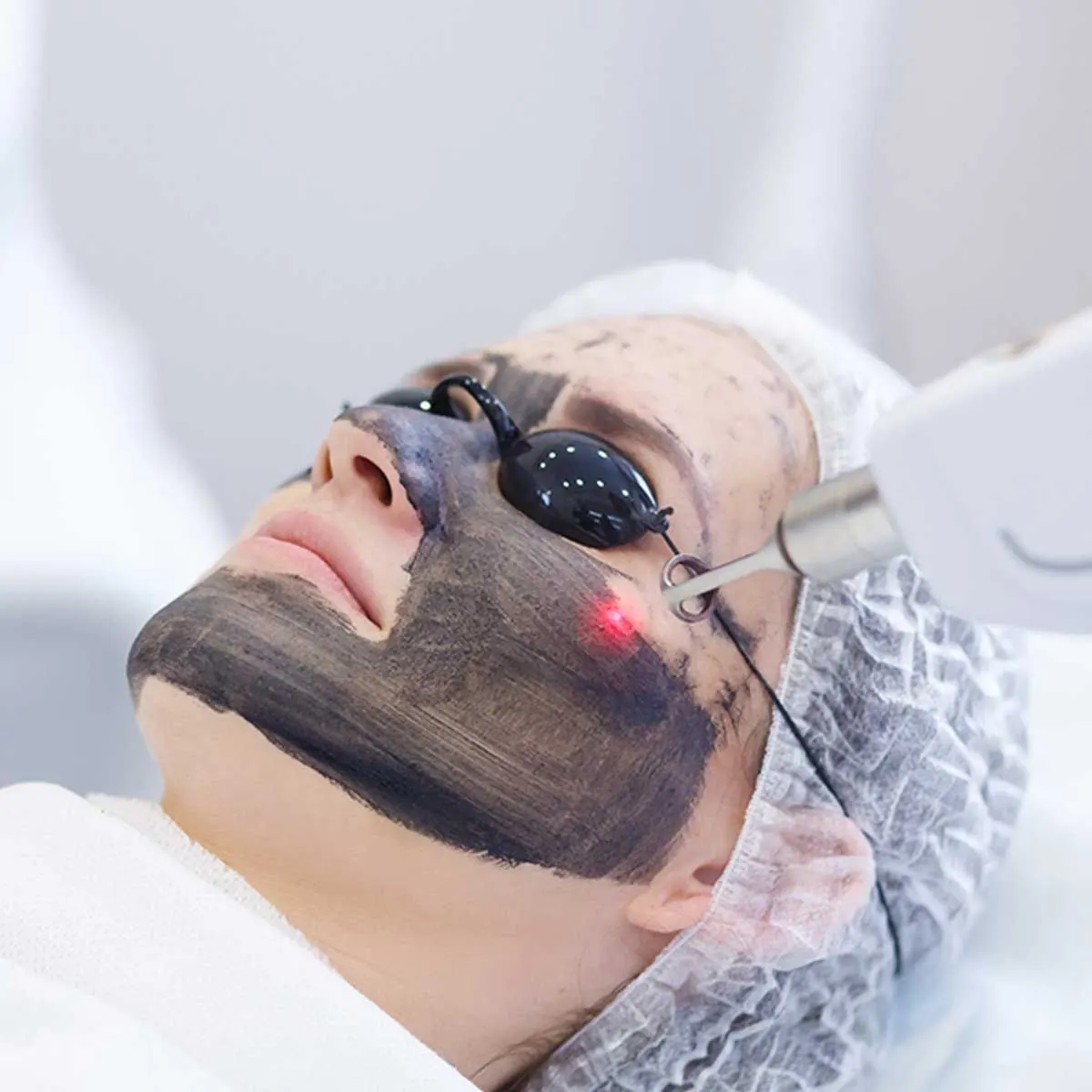Laser Pigmentation Treatment treatment at Kira Exotica, a beauty salon in Indore